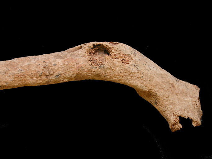 Náhledový obrázek kost klíční - fragment - 1